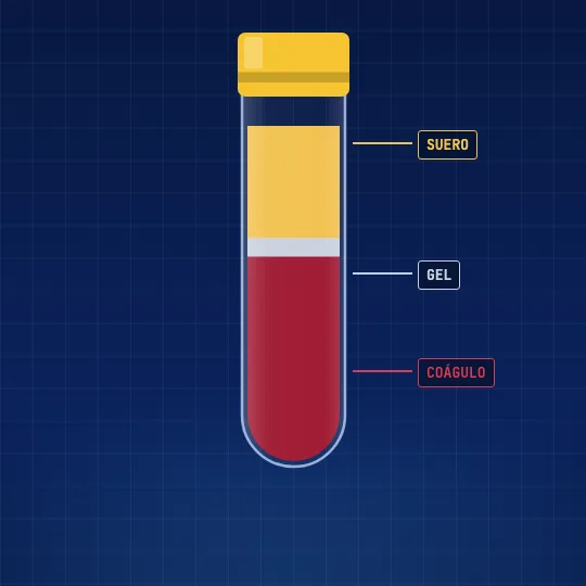 Tubo después de centrifugar: suero amarillo arriba, una capa de gel y el coágulo rojo abajo.