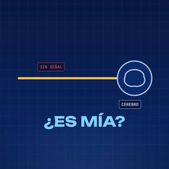 Un nervio que va de la pierna al cerebro; las señales se apagan y aparece la pregunta: ¿es mía?